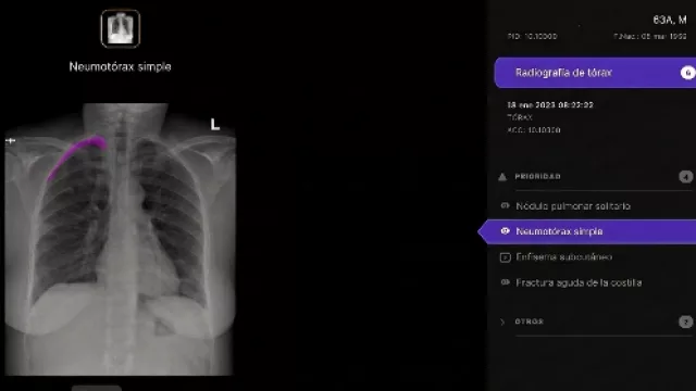 IA aplicada a la salud: Telefónica suma a Harrison.ai para potenciar el diagnóstico de radiografías